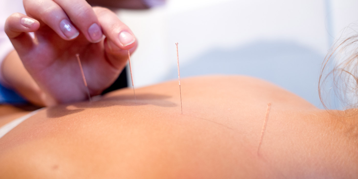 Acupuncture at Axis Chiropractic